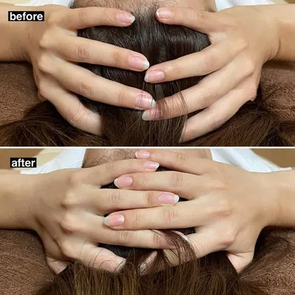 ビフォーアフター