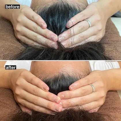 ビフォーアフター